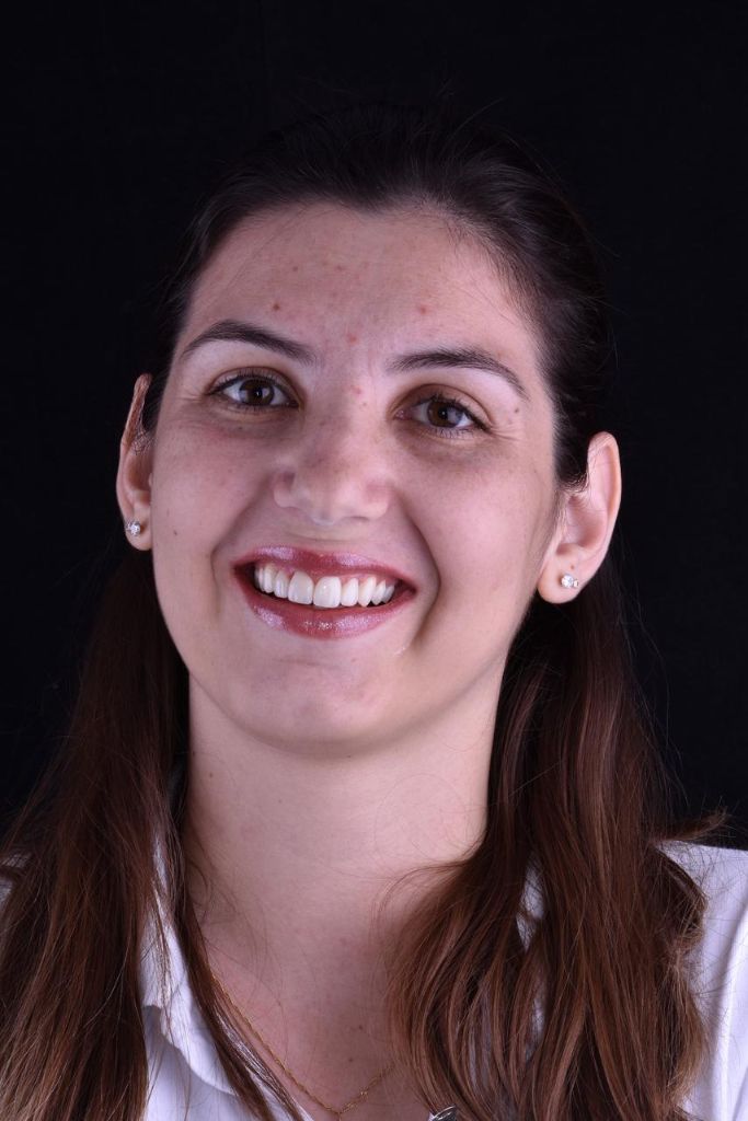 Después Sonrisa - Carillas de Resina Compuesta - Dra. Ivanova Guerrero CDMX